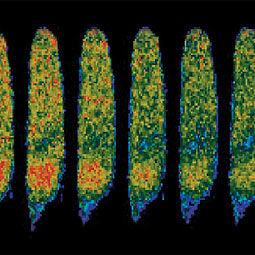 Calcium surges inside root hair cells of a legume after helpful bacteria 'knock on the door' by emitting a chemical called Nod factor.