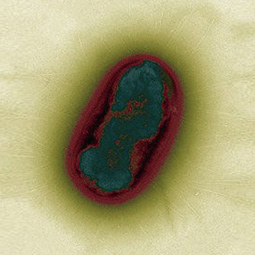 Electron photomicrograph of <em>Salmonella enterica</em> serotype Typhimurium, a bacterium that infects a wide range of hosts.