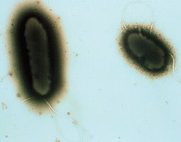Electron micrograph of cheatgrass suppressive bacteria. <em>Courtesy S. Gurusiddaiah and the WSU Franceschi Microscopy and Imaging Center.</em>
